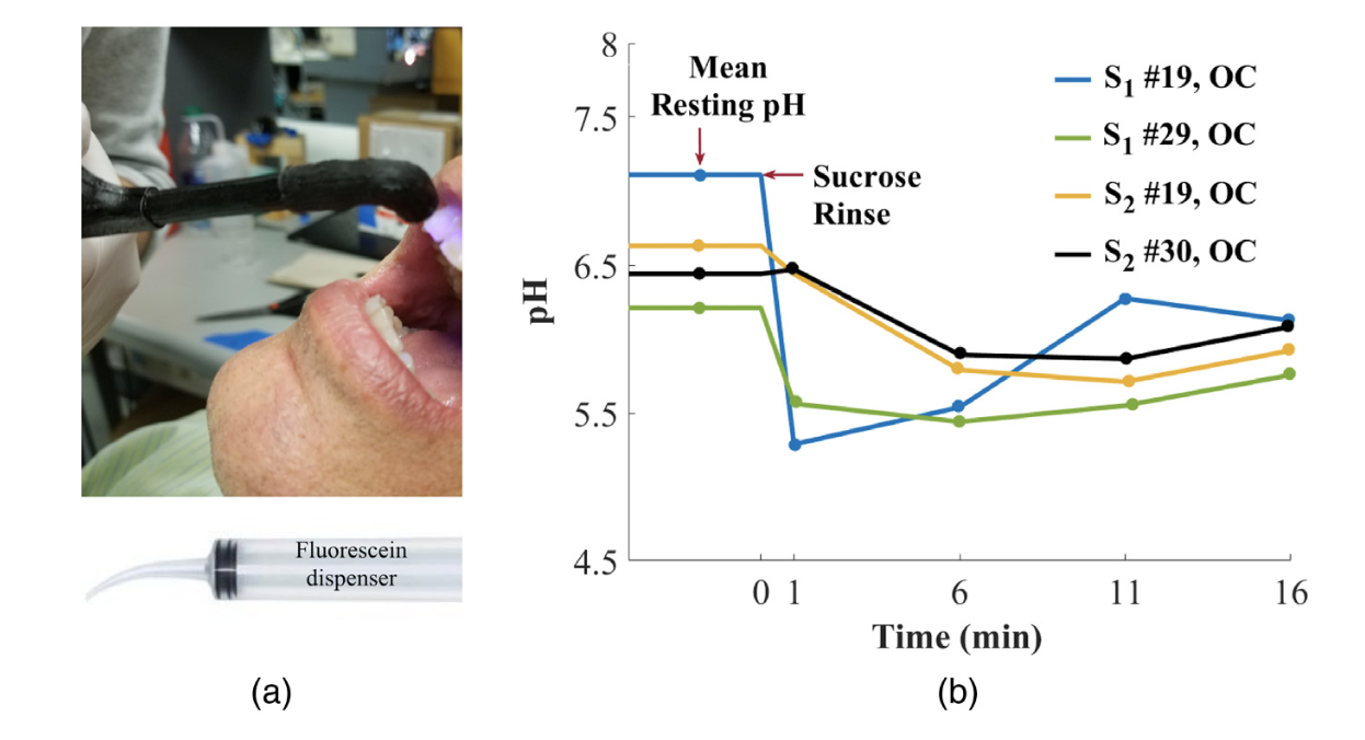 Optical Ph Measurement System Using A Single Fluorescent Dye For 